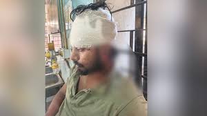 কুষ্টিয়ায় ছাত্রদলের হামলায় শিক্ষক গুরুতর আহত, মাথায় ১৬ সেলাই